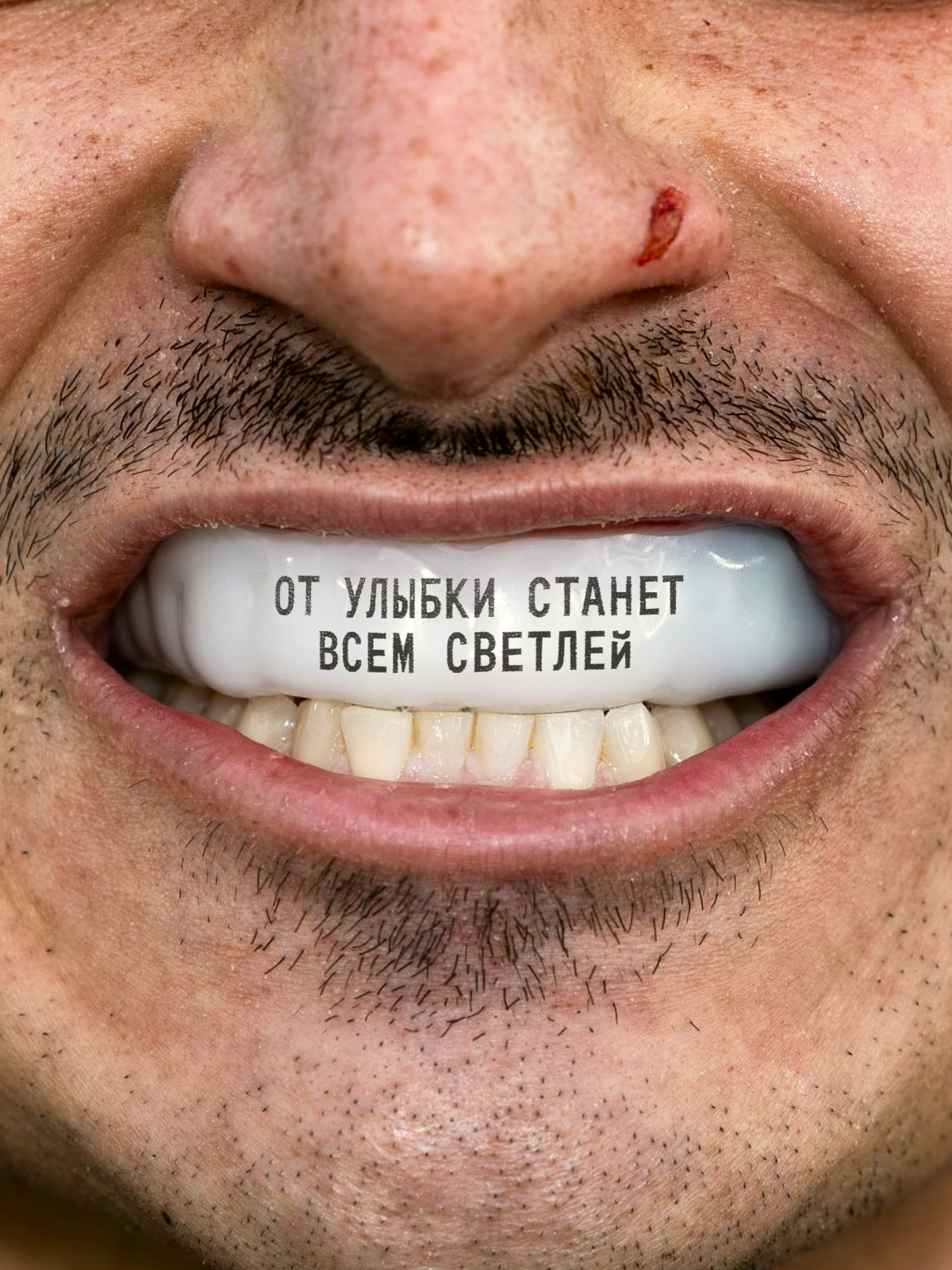 Mouthguard with the phrase From a Smile Everyone Gets Brighter
